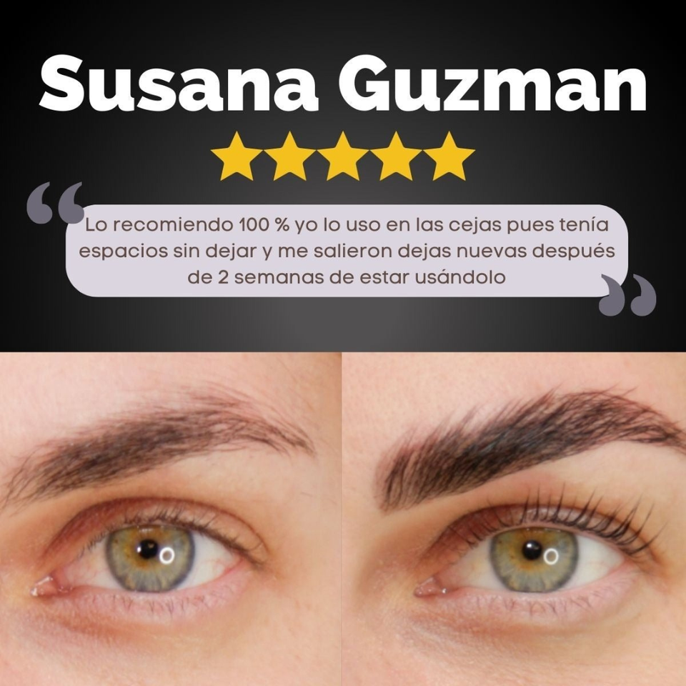 SERUM UP 🌸– Pestañas más largas y cejas más densas 💖